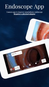 Endoscope App 1.6 screenshot